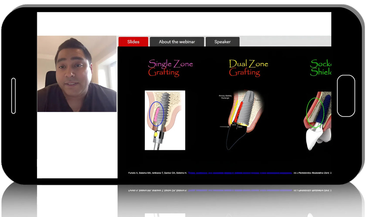 Digital Implant Therapy Utilizing Current Technology