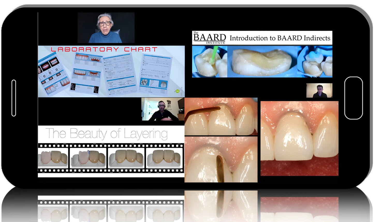 Orthopedics: Restoring chewing efficiency
