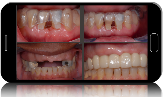 DSD Orthodontic Aligner Followship MasterClass