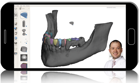 Advanced Implant Planning