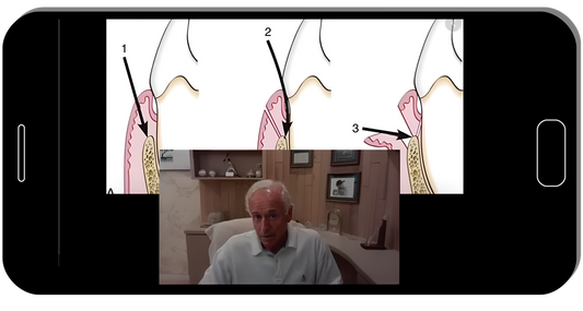 Advanced Periodontology, Surgical Protocols