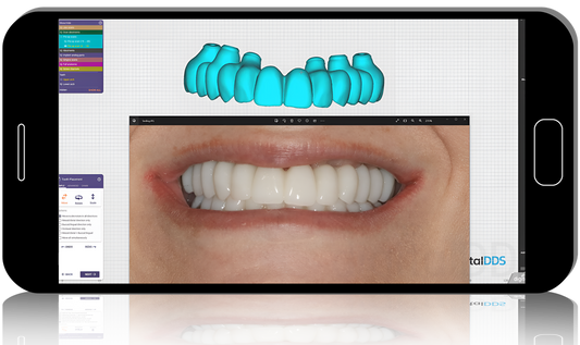 BASIC EXOCAD: Models, Crowns, Splints, Implant Crowns, AOX, & More
