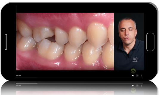 Adhesive Dentistry Procedures