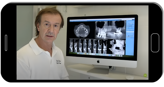 Advanced GBR. From socket preservation to vertical bone regeneration