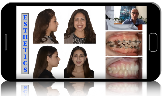 Orthodontic protocols by Raffaele Spena