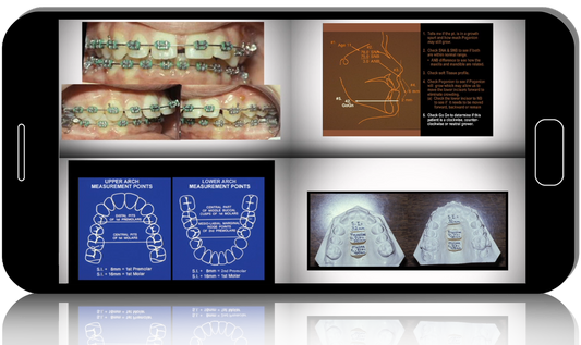 Straight Wire Concepts: Diagnosis and Technique