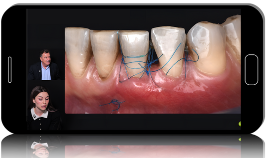 Advanced Techniques for a Paradigm Shift in Periodontal Regeneration