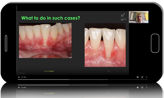 Advanced Periodontal Treatment
