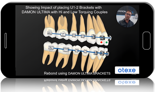 A Course on Damon Ultima