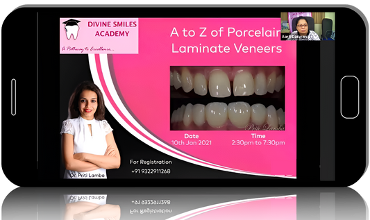 A to Z of Porcelain Laminate Veneers