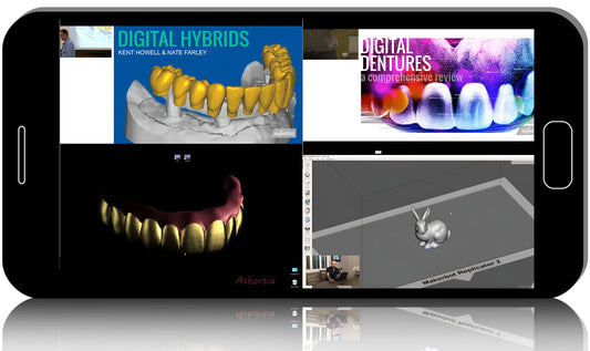 Digital Dentistry: From Scanner to CAD/CAM