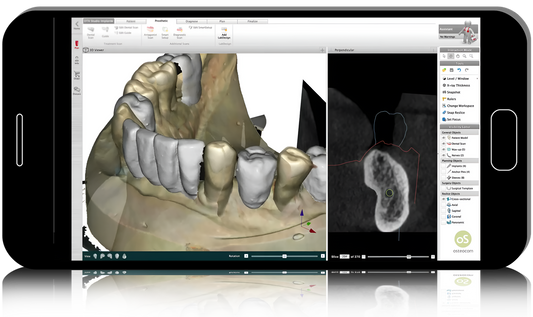 Digital Rehabilitation