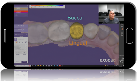 EXOCAD Implant Restorations - Step-by-step Video Guide 2023