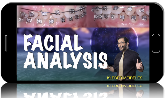 Finishing in orthodontics: aesthetics in the details